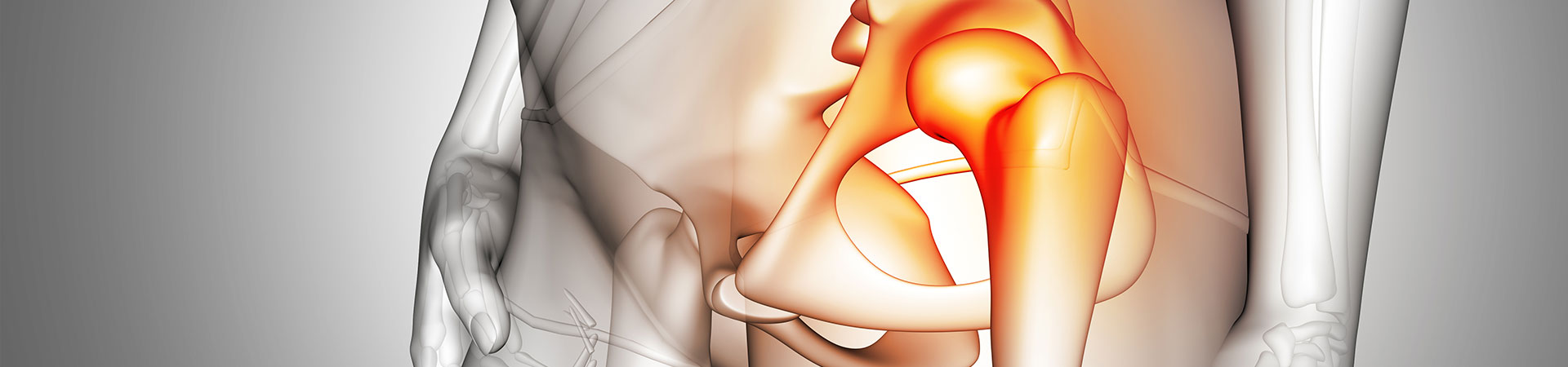 Management And Surgery For Conditions Of The Hip Asian Orthopedics