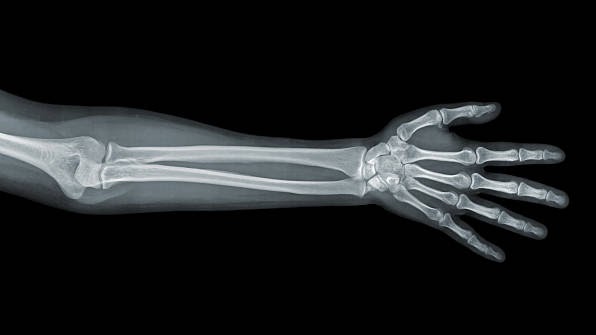Hand x-ray view on a black background